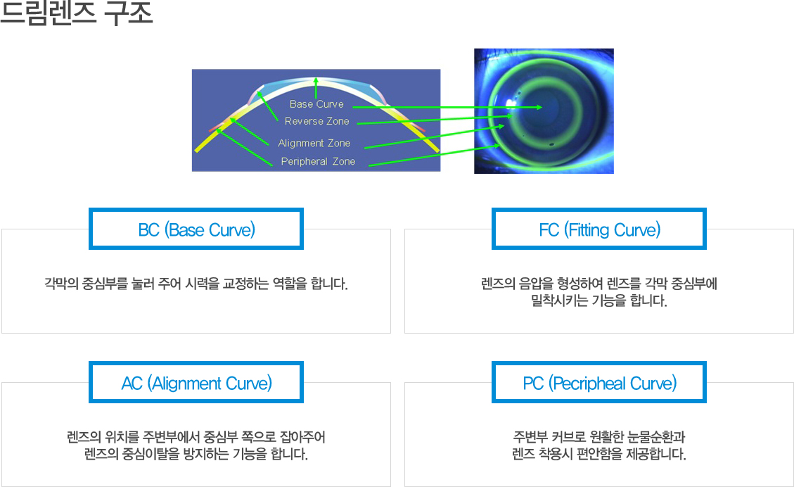 드림렌즈 구조
	BC (Base Curve) : 각막의 중심부를 눌러 주어 시력을 교정하는 역할을 합니다.
	FC (Fitting Curve) : 렌즈의 음압을 형성하여 렌즈를 각막 중심부에 밀착시키는 기능을 합니다.
	AC (Alignment Curve) : 렌즈의 위치를 주변부에서 중심부 쪽으로 잡아주어
렌즈의 중심이탈을 방지하는 기능을 합니다.
PC (Pecripheal Curve) : 주변부 커브로 원활한 눈물순환과 렌즈 착용시 편안함을 제공합니다.